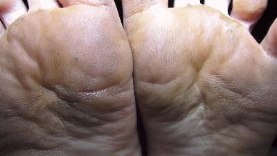 Levi Lynn's Dirty, Smelly Feet